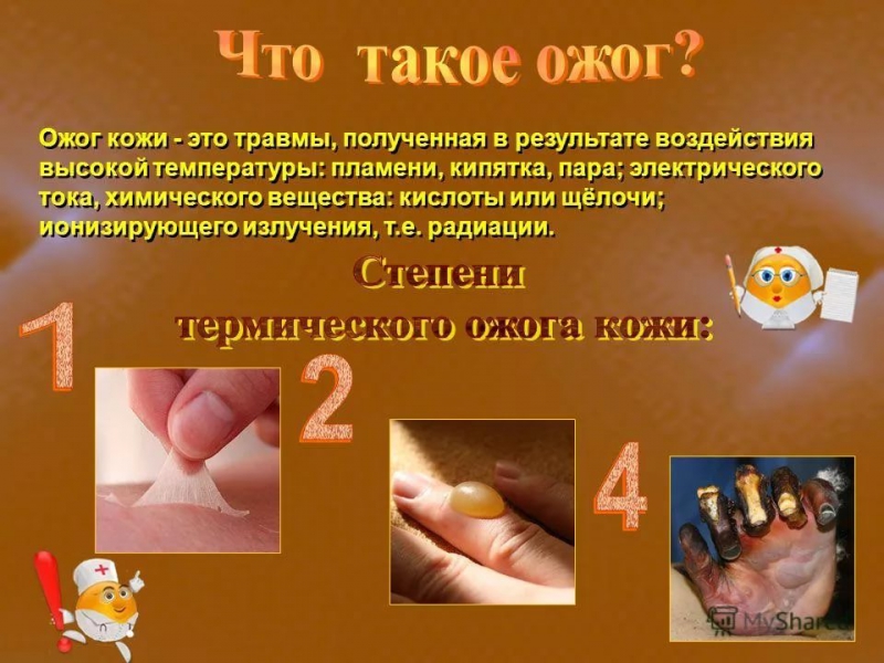 pervaya pomosch pri ozhogah